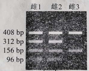 必修2-遗传与进化-伴性遗传概率计算